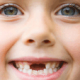 in-tooth