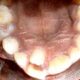 plus-tooth