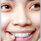 why-orthodontics